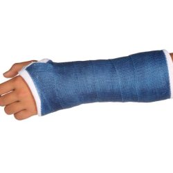 Types of hand splints occupational therapy