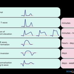 Ecg activity haspi answer key