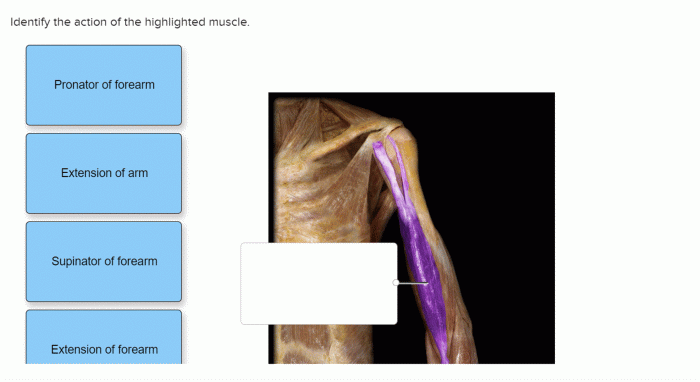 Describe the action of the highlighted muscle