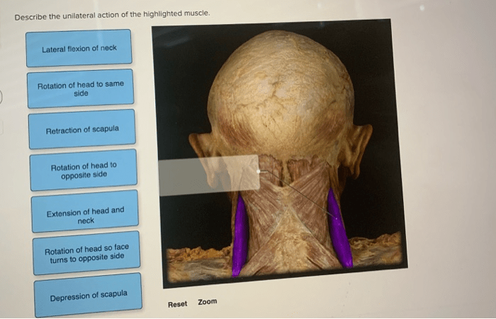 Describe the action of the highlighted muscle